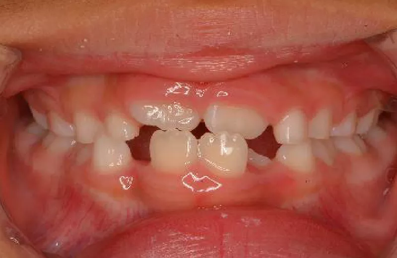 orthodontic