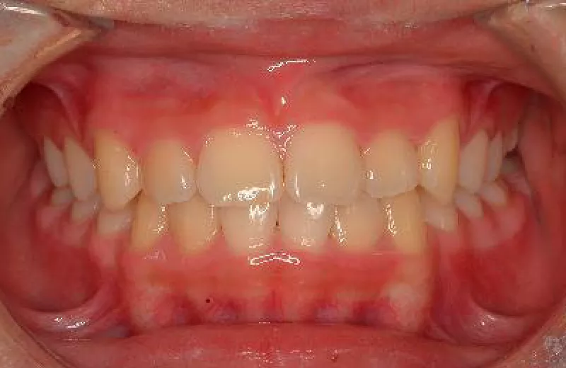 orthodontic